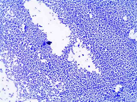 e coli capsule stain|simple stain e coli.